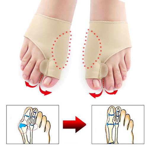 1Pair Hallux Valgus Braces Big Toe Orthopedic Correction Socks Toes Separator Feet Care Pain Protect Relieve Bone Thumb Sleeve