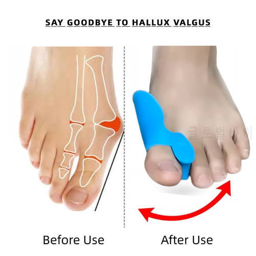 6pieces=3pairs Silicone Gel Big Toe Separators Thumb BCorrector Orthopedic Tools Feet Care Hallux Valgus Orthopsis