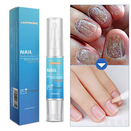 4ml Nail Repair Treatment Liquid Fungus Remover Protective Brush Nail Hand Pen Nourishing Foot Brightening Nail Care S6J8